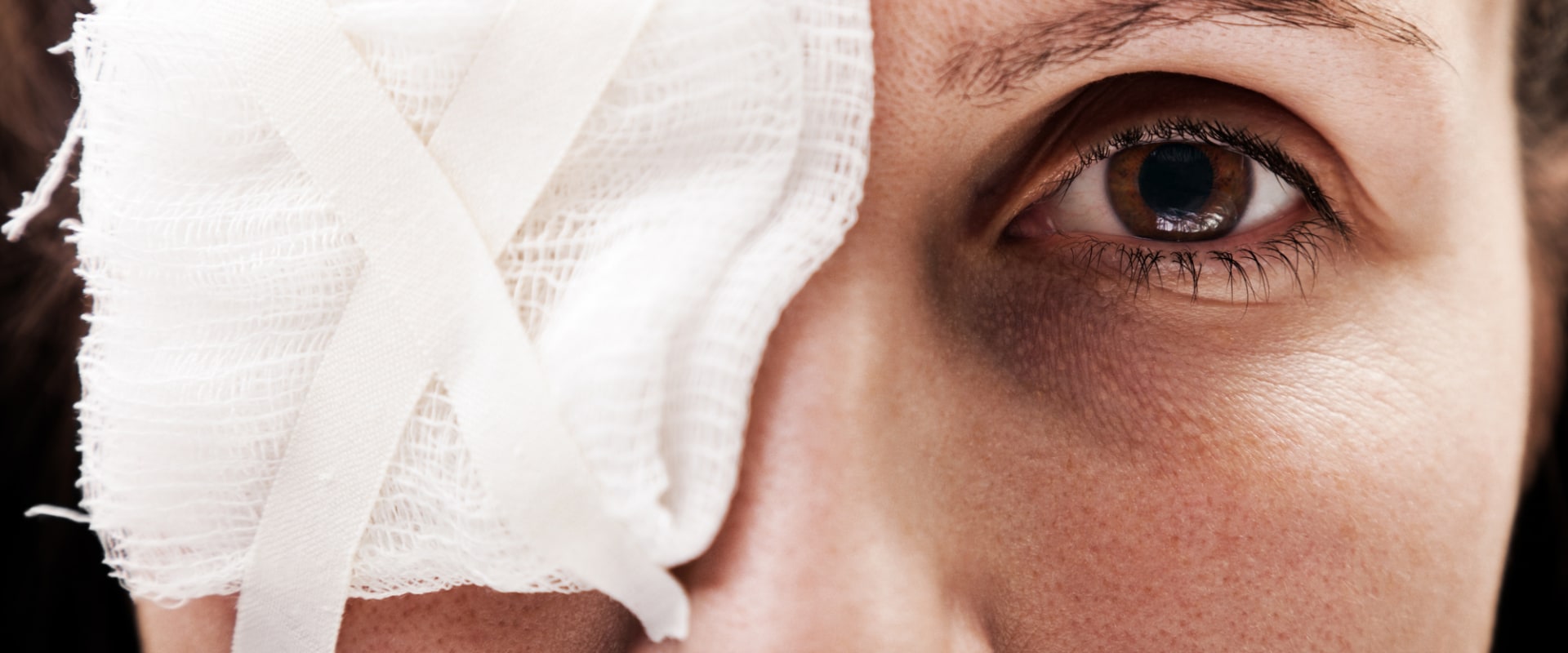 Can an Optometrist Treat Eye Injuries?