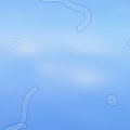 Can eye doctor see floaters?